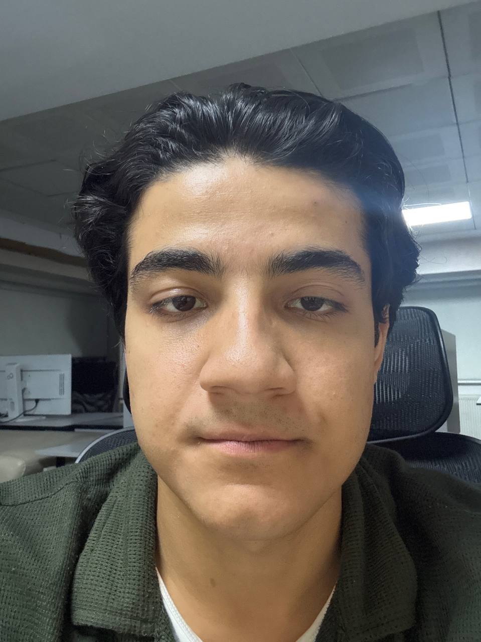 Khudoyorxon Askarov
